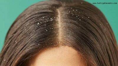 Saçlardaki Kepeğe Karşı Karbonat