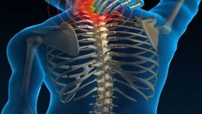 Spinal Kord Yaralanmaları